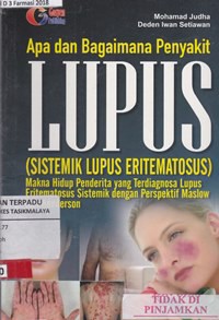 Apa dan bagaimana penyakit lupus